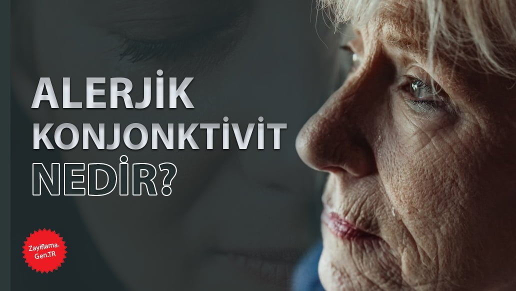 Alerjik Konjonktivit Nedir?