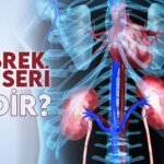 Böbrek Kanseri Nedir?