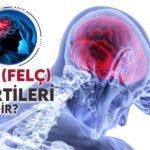 İnme Felç Nedir Belirti ve Tedavi Yöntemleri Nelerdir?