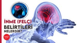 İnme Felç Nedir Belirti ve Tedavi Yöntemleri Nelerdir?